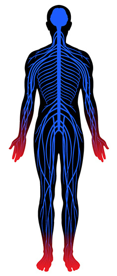 neuropathy